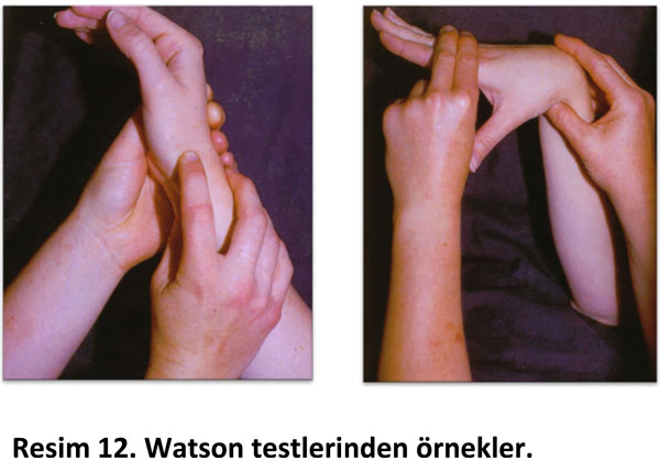 el-bilek-a-r-s-instabilite-12