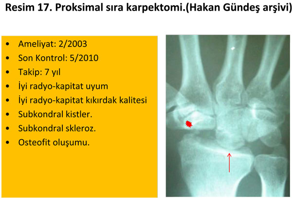 el-bilek-a-r-s-instabilite-17