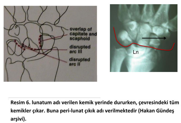el-bilek-instabilite1
